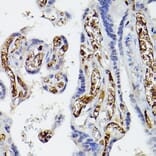 Immunohistochemistry - Anti-Apolipoprotein E Antibody (A11138) - Antibodies.com