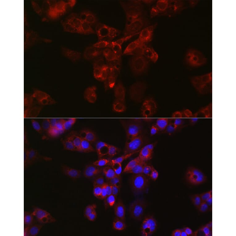 Immunofluorescence - Anti-Apolipoprotein E Antibody (A11138) - Antibodies.com