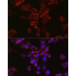 Immunofluorescence - Anti-Apolipoprotein E Antibody (A11138) - Antibodies.com