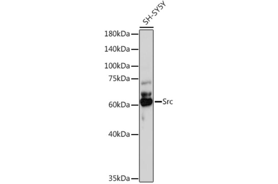 Western Blot - Anti-Src Antibody (A11140) - Antibodies.com