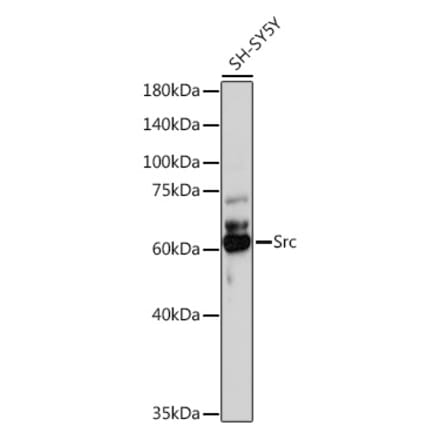 Western Blot - Anti-Src Antibody (A11140) - Antibodies.com