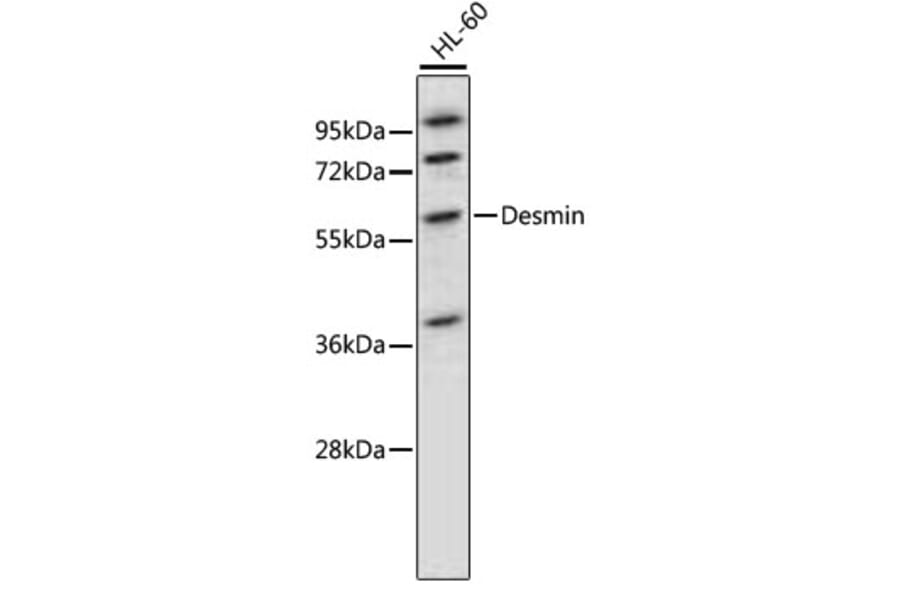 Western Blot - Anti-DES Antibody (A0356) - Antibodies.com