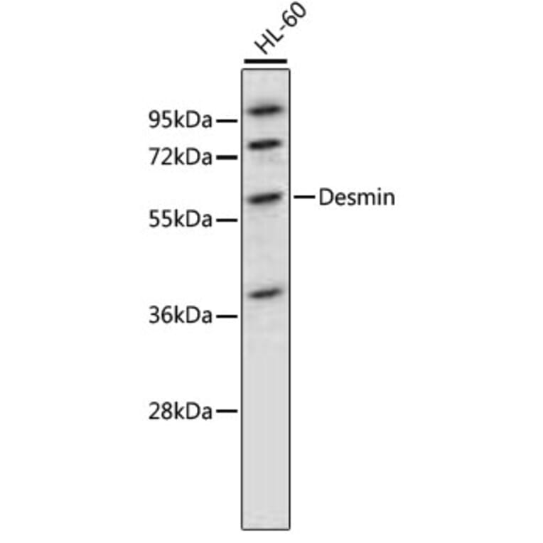 Western Blot - Anti-DES Antibody (A0356) - Antibodies.com