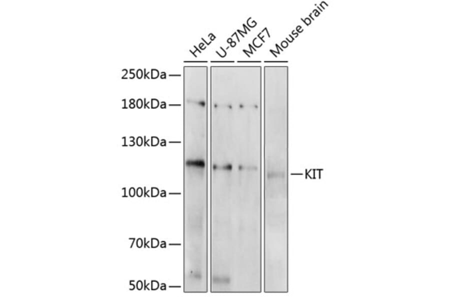Western Blot - Anti-KIT Antibody (A0358) - Antibodies.com
