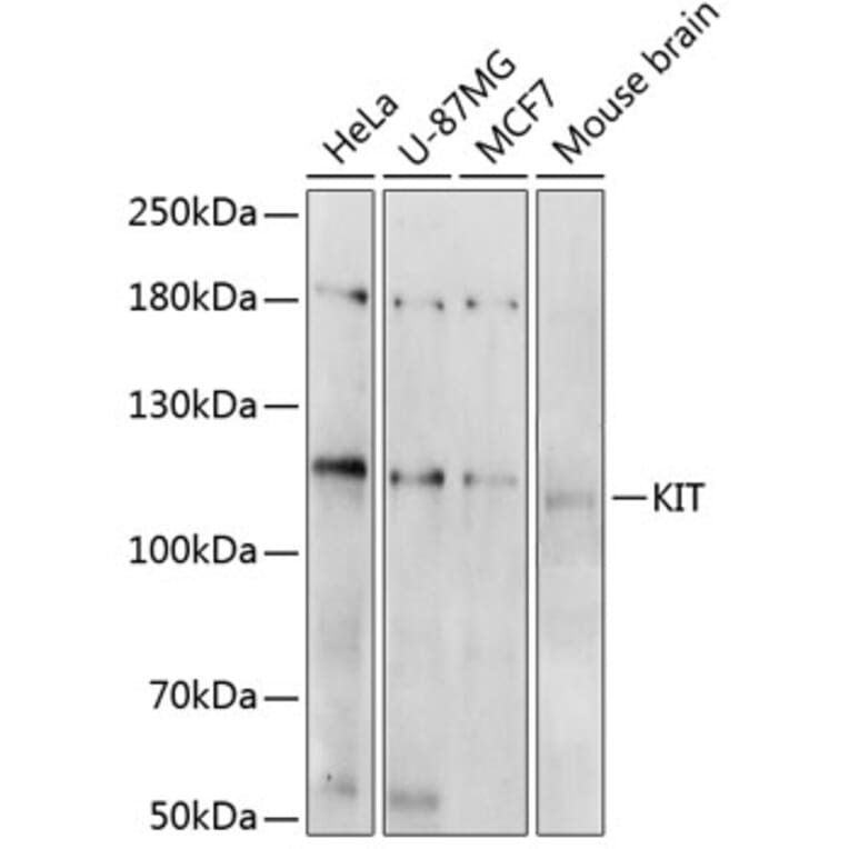Western Blot - Anti-KIT Antibody (A0358) - Antibodies.com