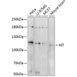 Western Blot - Anti-KIT Antibody (A0358) - Antibodies.com