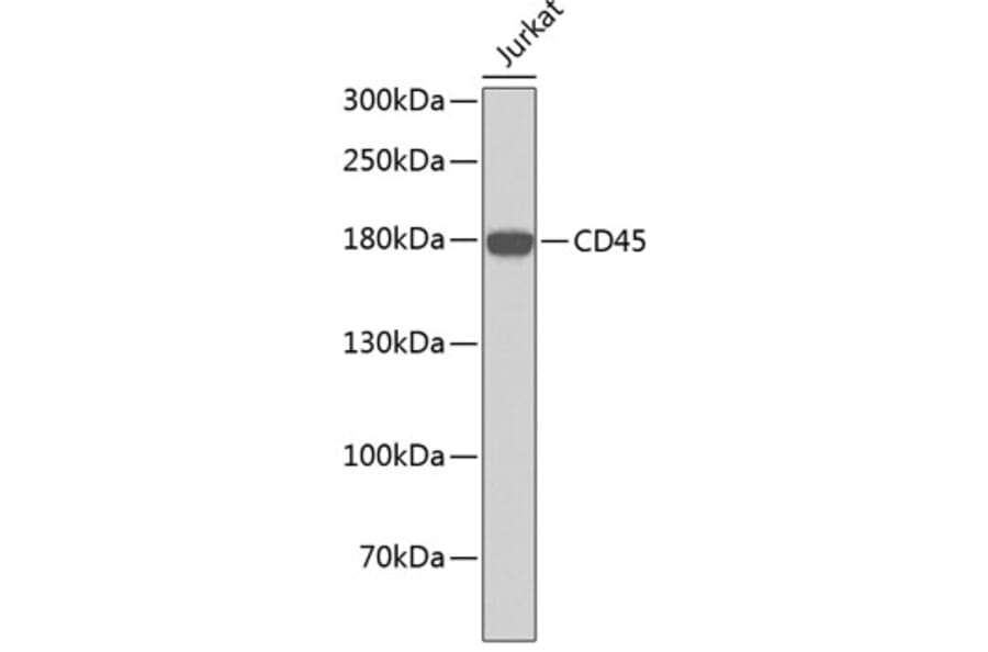 Western Blot - Anti-PTPRC Antibody (A0373) - Antibodies.com