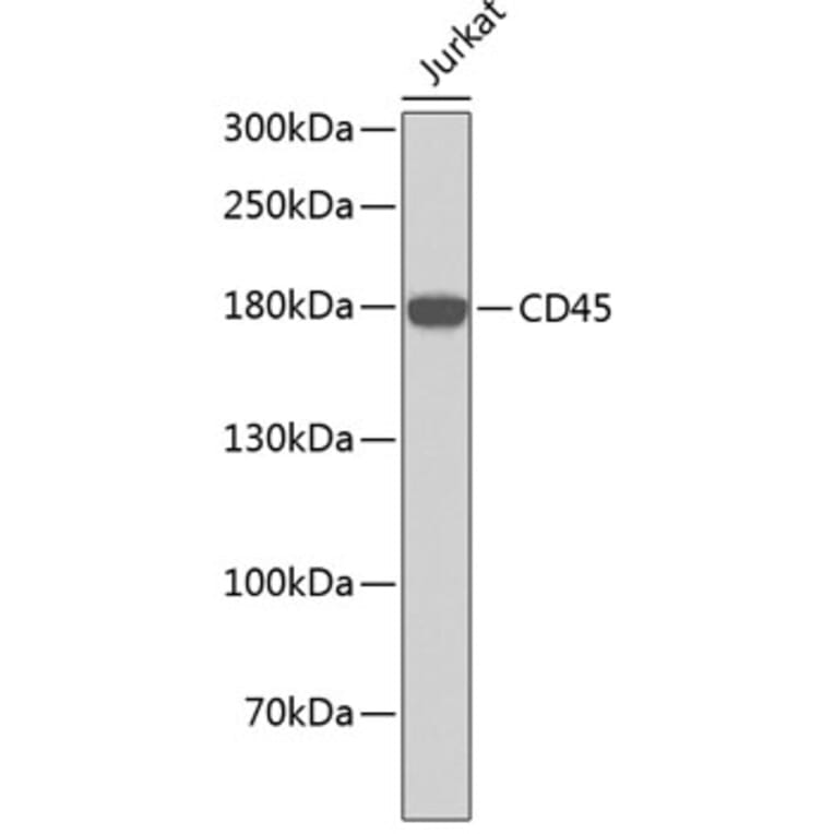 Western Blot - Anti-PTPRC Antibody (A0373) - Antibodies.com