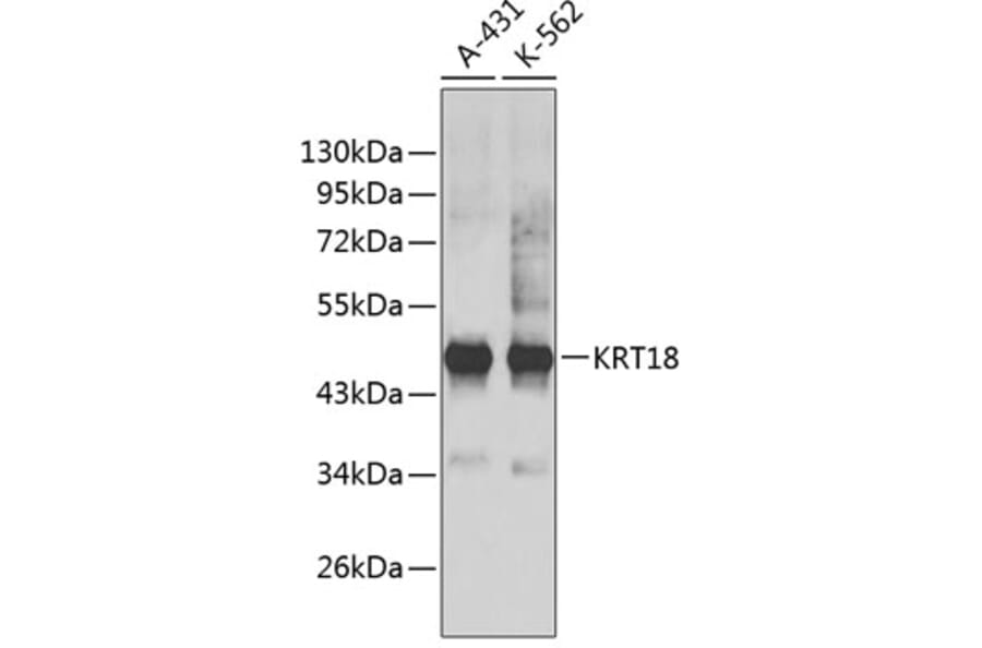 Western Blot - Anti-KRT18 Antibody (A0388) - Antibodies.com
