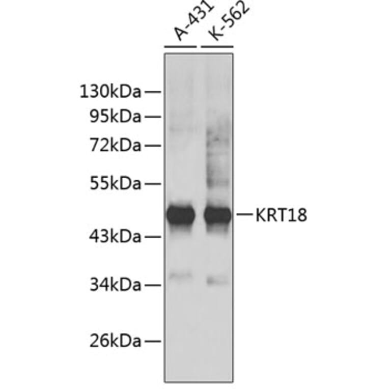 Western Blot - Anti-KRT18 Antibody (A0388) - Antibodies.com