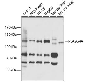 Western Blot - Anti-Cytosolic Phospholipase A2 Antibody (A11147) - Antibodies.com