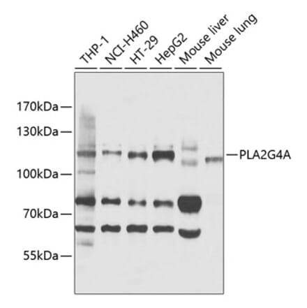 Western Blot - Anti-Cytosolic Phospholipase A2 Antibody (A11147) - Antibodies.com