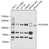 Western Blot - Anti-Cytosolic Phospholipase A2 Antibody (A11147) - Antibodies.com