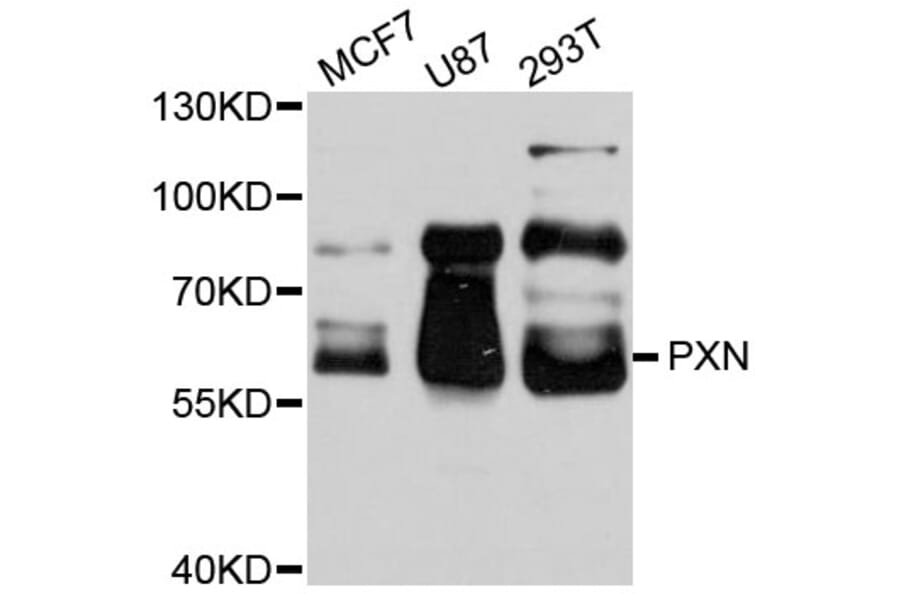Western Blot - Anti-PXN Antibody (A0395) - Antibodies.com