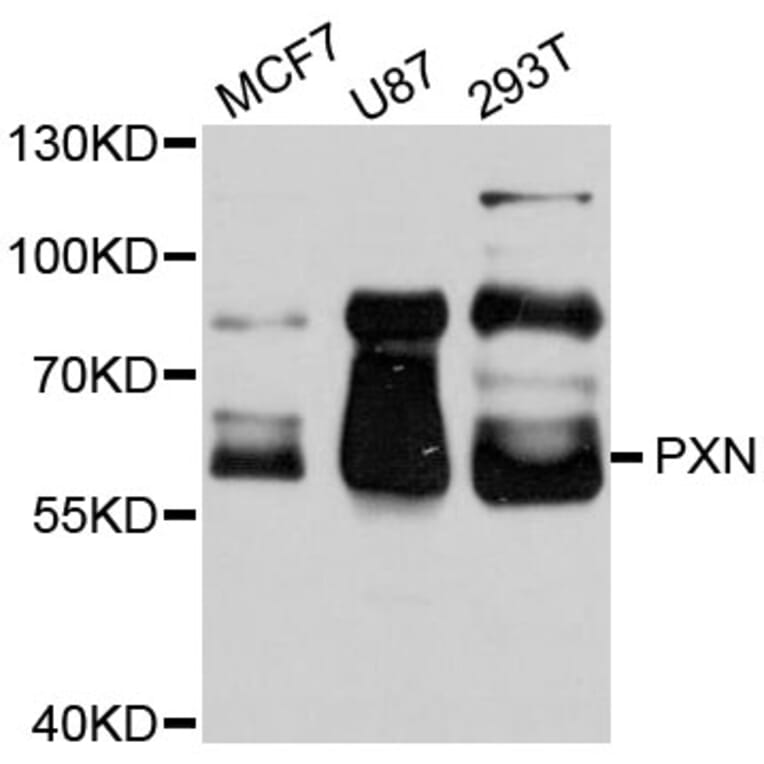 Western Blot - Anti-PXN Antibody (A0395) - Antibodies.com