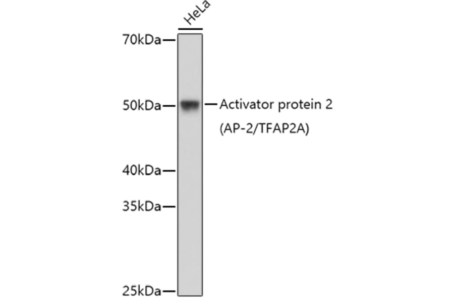 Western Blot - Anti-Transcription factor AP-2-alpha Antibody (A11149) - Antibodies.com