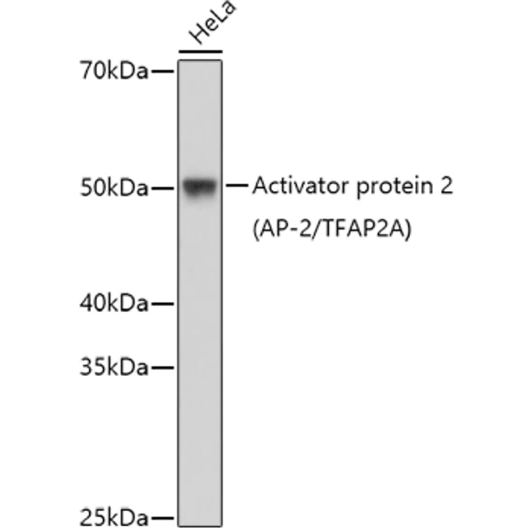 Western Blot - Anti-Transcription factor AP-2-alpha Antibody (A11149) - Antibodies.com