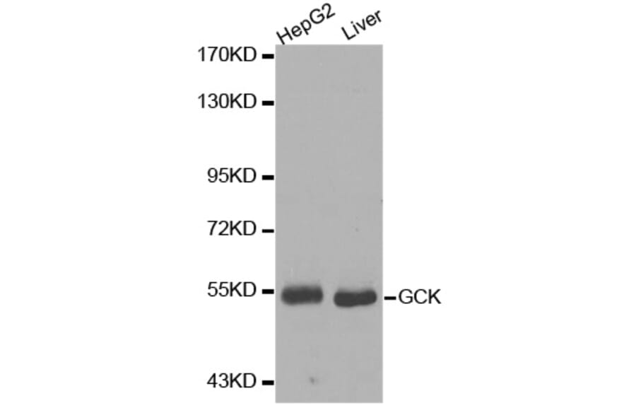 Western Blot - Anti-GCK Antibody (A0430) - Antibodies.com