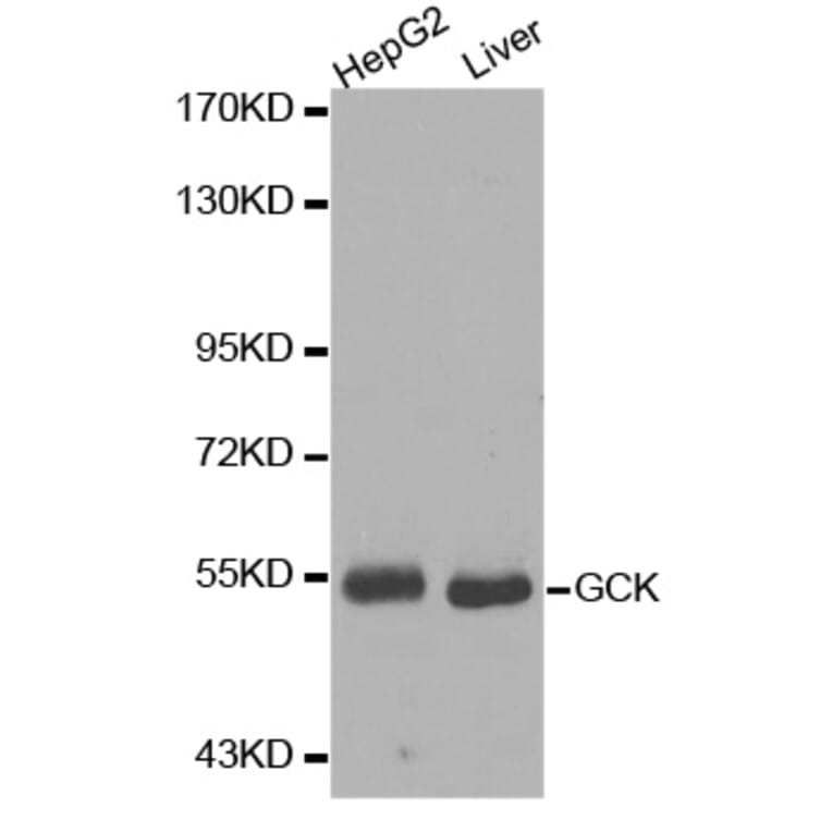 Western Blot - Anti-GCK Antibody (A0430) - Antibodies.com