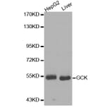 Western Blot - Anti-GCK Antibody (A0430) - Antibodies.com