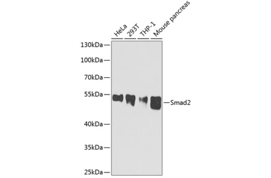 Western Blot - Anti-Smad2 Antibody (A0441) - Antibodies.com