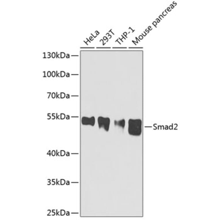 Western Blot - Anti-Smad2 Antibody (A0441) - Antibodies.com