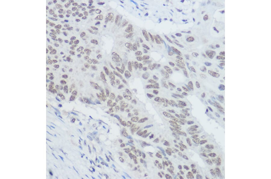 Immunohistochemistry - Anti-XRCC1 Antibody (A11152) - Antibodies.com