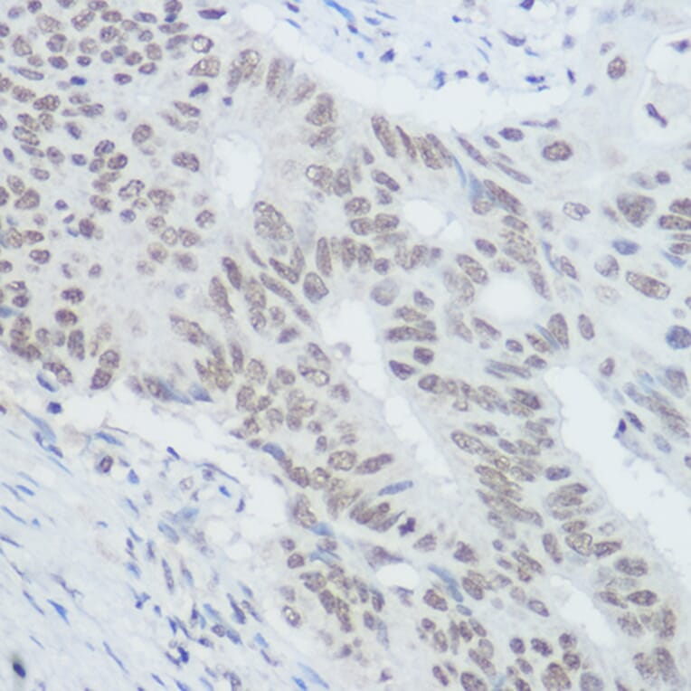 Immunohistochemistry - Anti-XRCC1 Antibody (A11152) - Antibodies.com