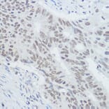 Immunohistochemistry - Anti-XRCC1 Antibody (A11152) - Antibodies.com