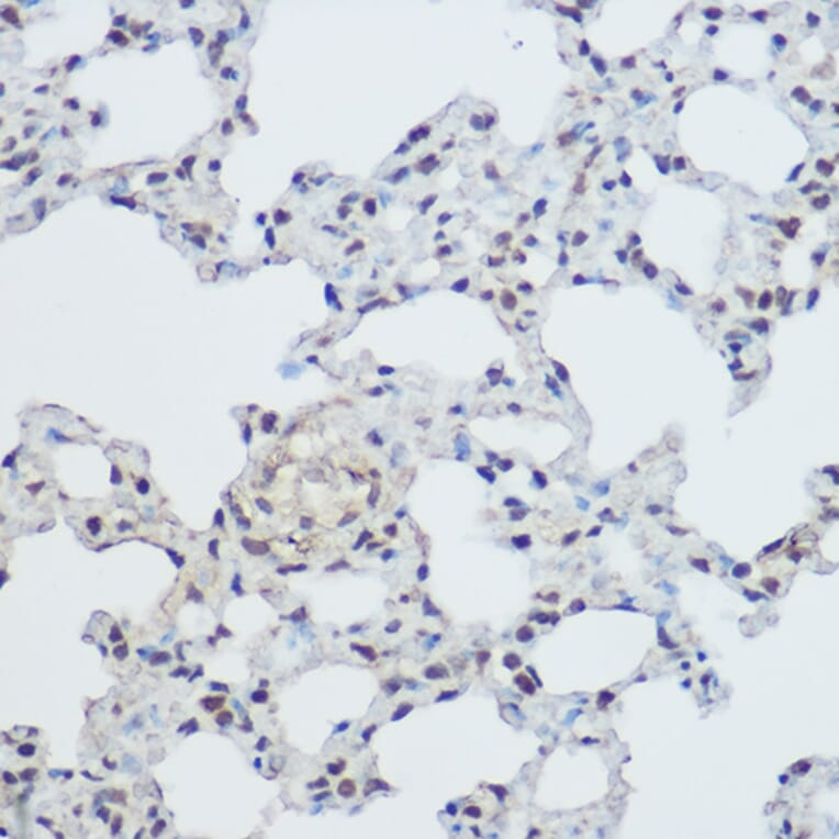 Immunohistochemistry - Anti-XRCC1 Antibody (A11152) - Antibodies.com