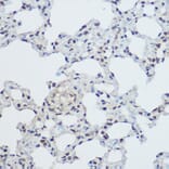 Immunohistochemistry - Anti-XRCC1 Antibody (A11152) - Antibodies.com