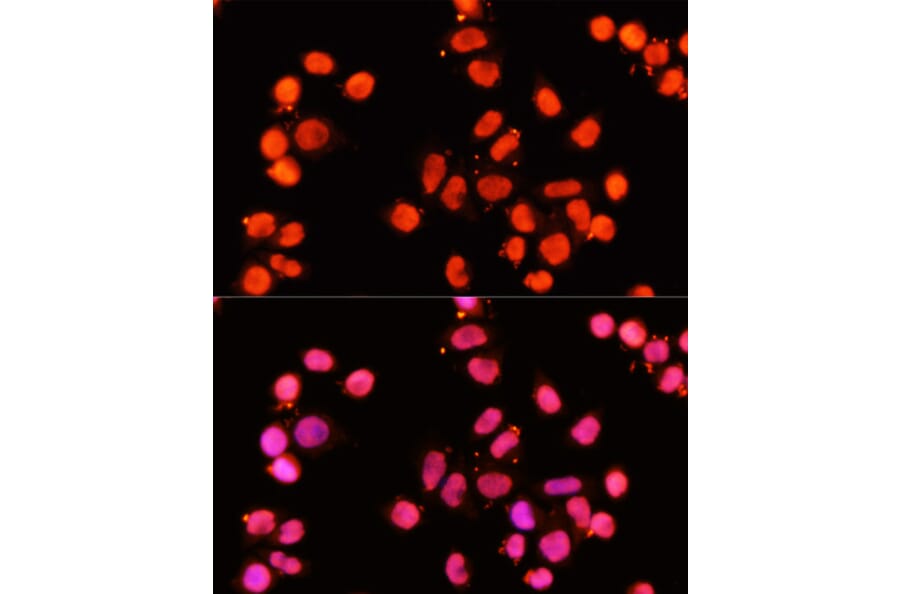 Immunofluorescence - Anti-XRCC1 Antibody (A11152) - Antibodies.com