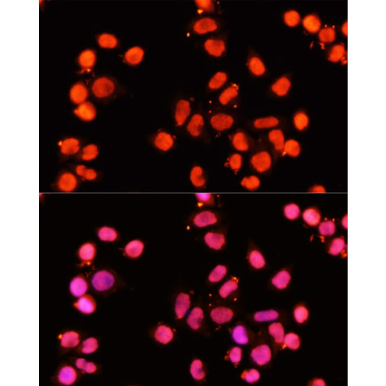 Immunofluorescence - Anti-XRCC1 Antibody (A11152) - Antibodies.com