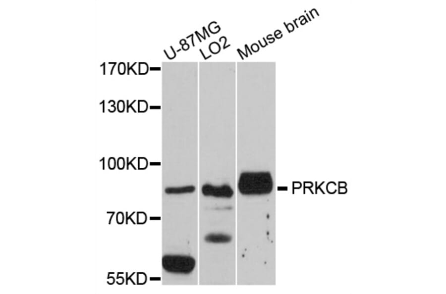 Western Blot - Anti-PRKCB Antibody (A0495) - Antibodies.com
