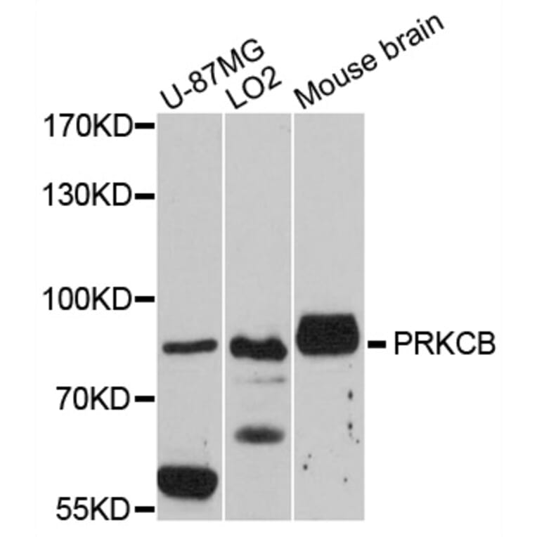 Western Blot - Anti-PRKCB Antibody (A0495) - Antibodies.com