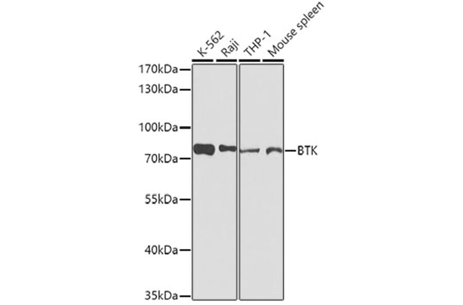 Western Blot - Anti-BTK Antibody (A0500) - Antibodies.com