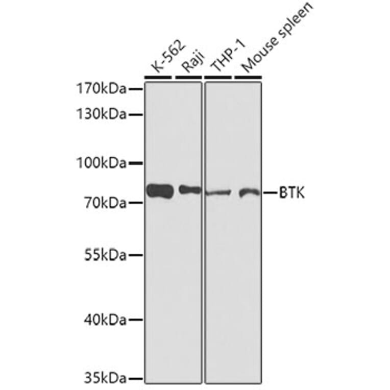 Western Blot - Anti-BTK Antibody (A0500) - Antibodies.com