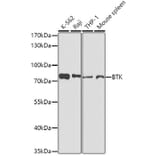Western Blot - Anti-BTK Antibody (A0500) - Antibodies.com