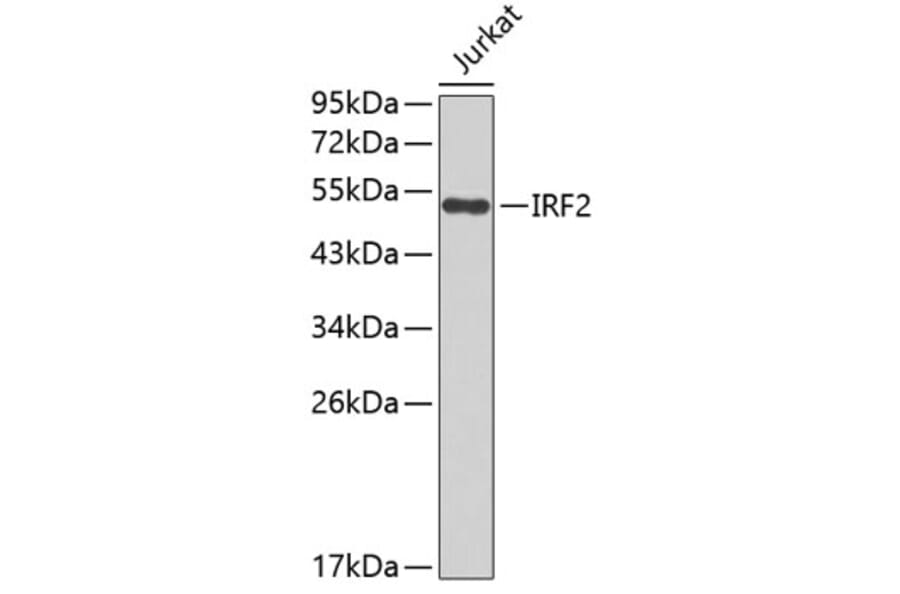 Western Blot - Anti-IRF2 Antibody (A0508) - Antibodies.com