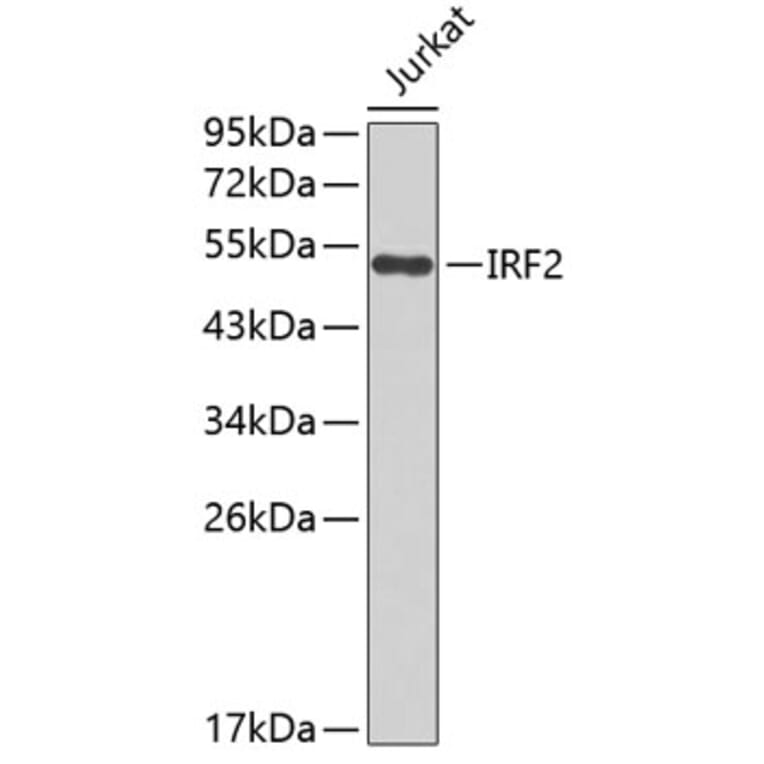 Western Blot - Anti-IRF2 Antibody (A0508) - Antibodies.com
