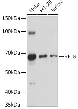 Western blot analysis of extracts of various cell lines, using Anti-RELB Antibody (A0519) at 1:1,000 dilution.
Secondary antibody: Goat Anti-Rabbit IgG (H+L) (HRP) (AS014) at 1:10,000 dilution.
Lysates / proteins: 25µg per lane.
Blocking buffer: 3% non-fat dry milk in TBST.
Detection: ECL Basic Kit (RM00020).
Exposure time: 90s.