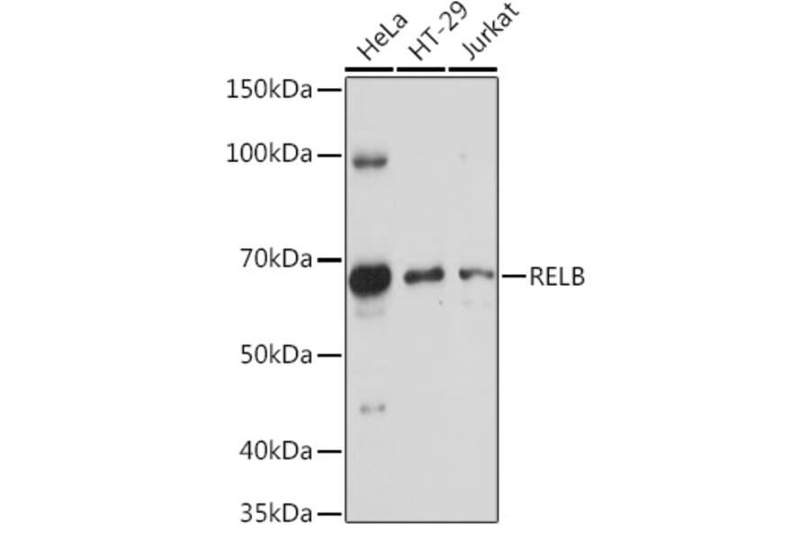 Western Blot - Anti-Rel B Antibody (A11158) - Antibodies.com