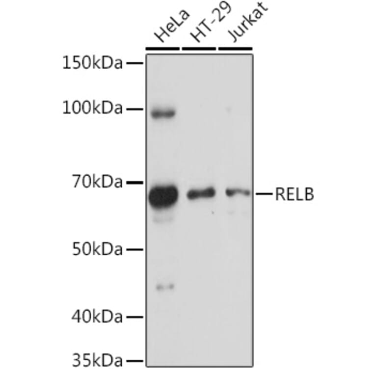 Western Blot - Anti-Rel B Antibody (A11158) - Antibodies.com