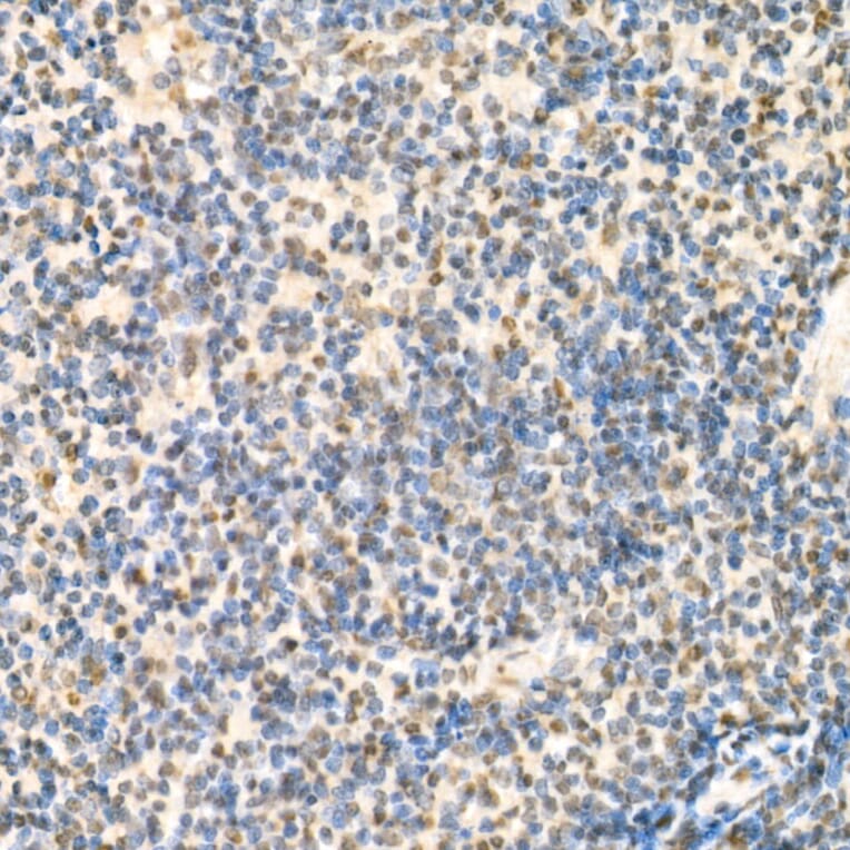 Immunohistochemistry - Anti-Rel B Antibody (A11158) - Antibodies.com