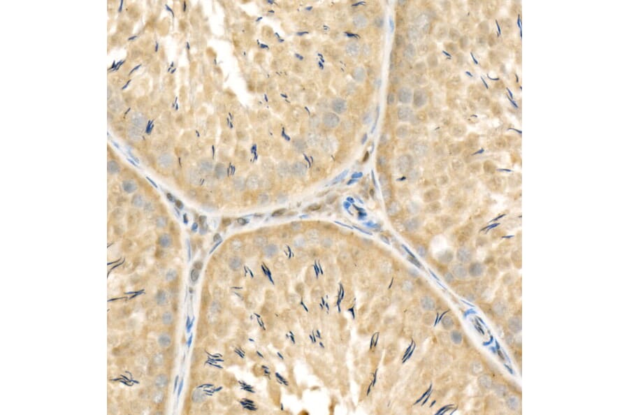 Immunohistochemistry - Anti-Rel B Antibody (A11158) - Antibodies.com