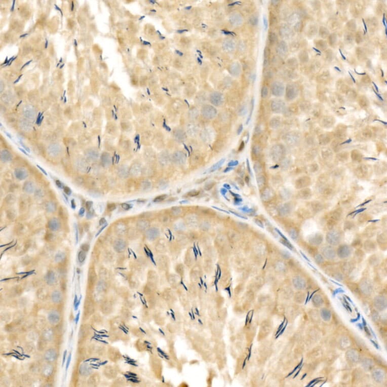 Immunohistochemistry - Anti-Rel B Antibody (A11158) - Antibodies.com