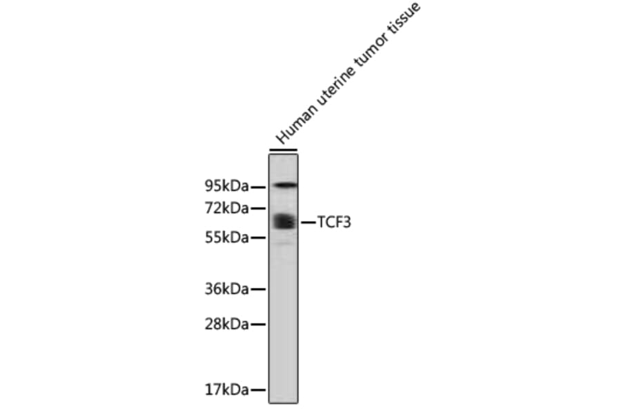 Western Blot - Anti-TCF3 Antibody (A0520) - Antibodies.com