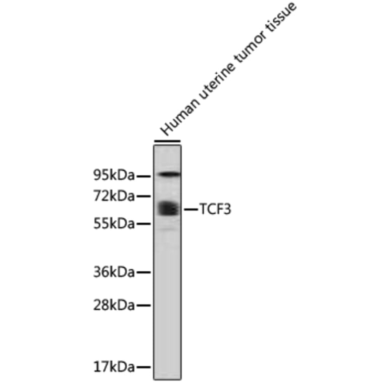Western Blot - Anti-TCF3 Antibody (A0520) - Antibodies.com