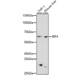 Western Blot - Anti-MUM1 Antibody (A11160) - Antibodies.com