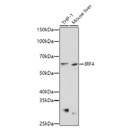 Western Blot - Anti-MUM1 Antibody (A11160) - Antibodies.com